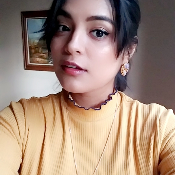 UO Chic Yellow Dress - Picture 5 of 5